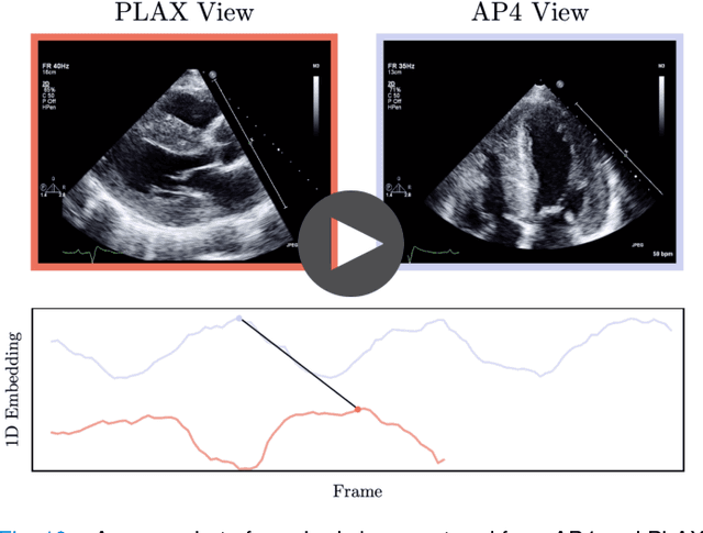 Figure 2 for Echo-SyncNet: Self-supervised Cardiac View Synchronization in Echocardiography
