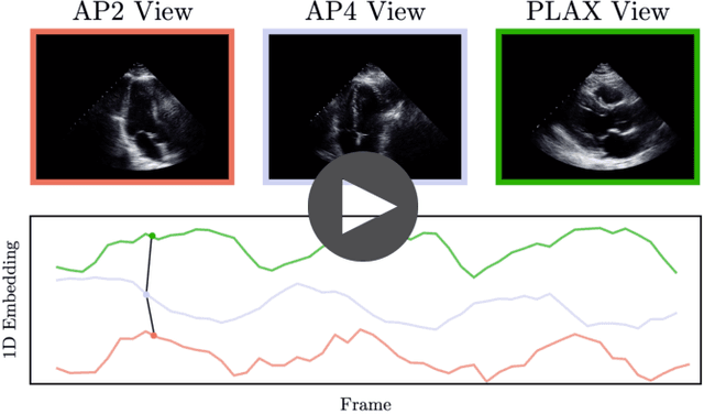 Figure 3 for Echo-SyncNet: Self-supervised Cardiac View Synchronization in Echocardiography