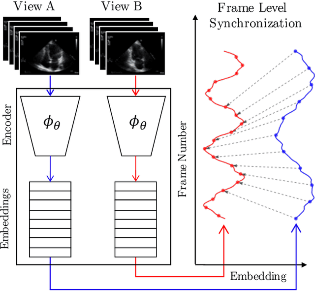 Figure 1 for Echo-SyncNet: Self-supervised Cardiac View Synchronization in Echocardiography