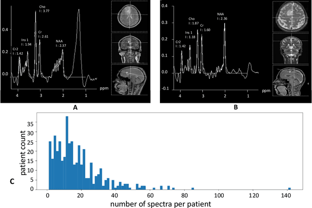Figure 1 for Multiple Instance Learning for Brain Tumor Detection from Magnetic Resonance Spectroscopy Data