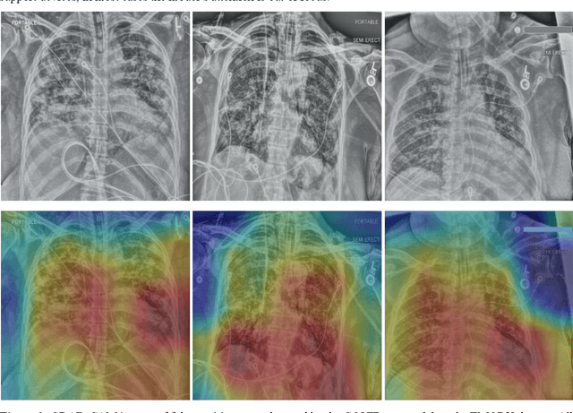 Figure 4 for Was there COVID-19 back in 2012? Challenge for AI in Diagnosis with Similar Indications