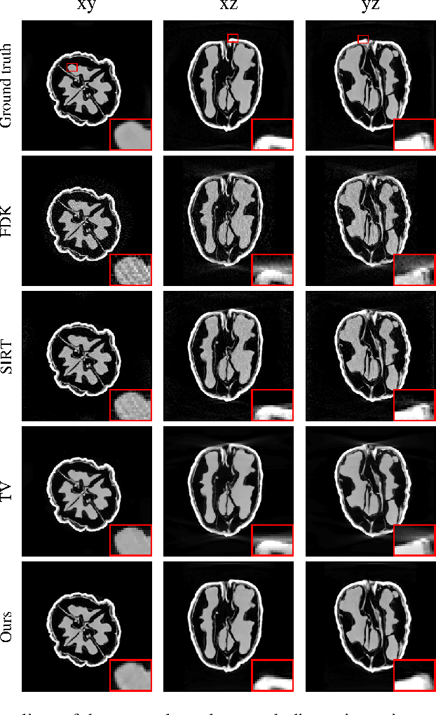 Figure 3 for Learned Cone-Beam CT Reconstruction Using Neural Ordinary Differential Equations
