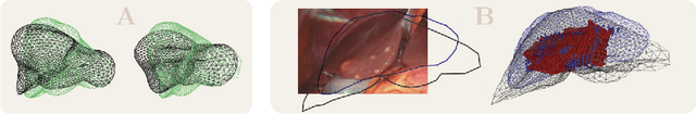 Figure 2 for Intraoperative Liver Surface Completion with Graph Convolutional VAE