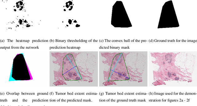 Figure 2 for Overcoming the limitations of patch-based learning to detect cancer in whole slide images