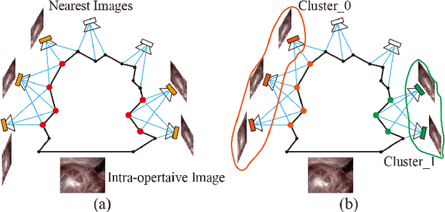 Figure 4 for Stereo Dense Scene Reconstruction and Accurate Laparoscope Localization for Learning-Based Navigation in Robot-Assisted Surgery