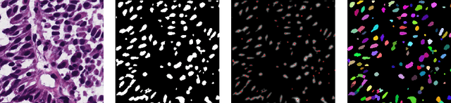 Figure 3 for Self-Supervised Nuclei Segmentation in Histopathological Images Using Attention