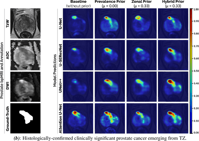 Figure 3 for Encoding Clinical Priori in 3D Convolutional Neural Networks for Prostate Cancer Detection in bpMRI