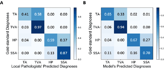 Figure 4 for Deep neural networks for automated classification of colorectal polyps on histopathology slides: A multi-institutional evaluation