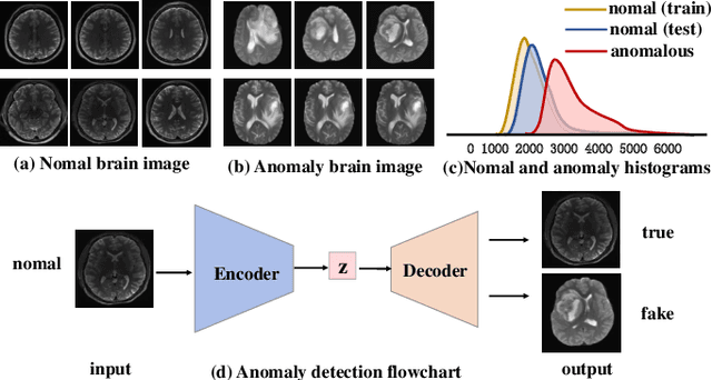 Figure 1 for Brain Tumor Anomaly Detection via Latent Regularized Adversarial Network