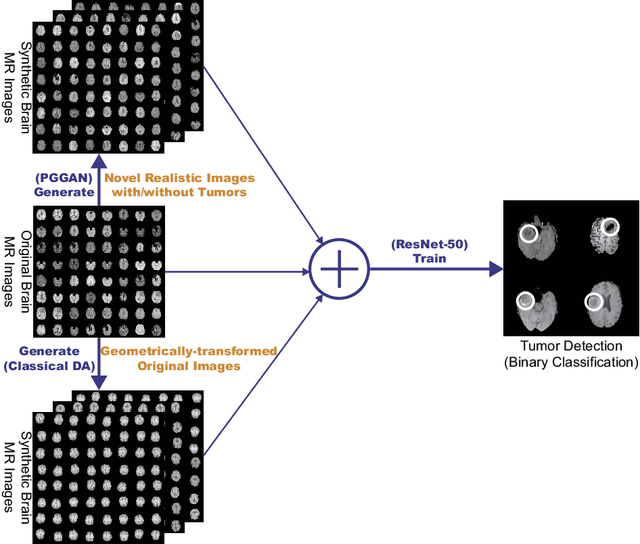 Figure 1 for Infinite Brain MR Images: PGGAN-based Data Augmentation for Tumor Detection
