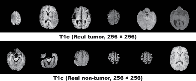 Figure 3 for Infinite Brain MR Images: PGGAN-based Data Augmentation for Tumor Detection