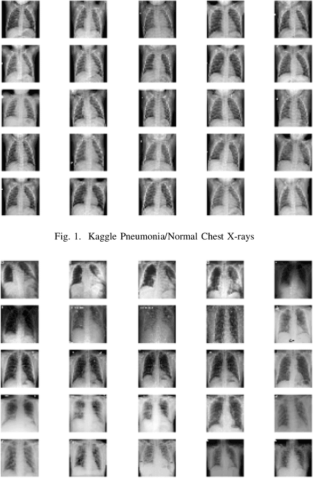 Figure 1 for Generating Realistic COVID19 X-rays with a Mean Teacher + Transfer Learning GAN