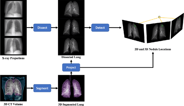 Figure 1 for X-ray Dissectography Improves Lung Nodule Detection