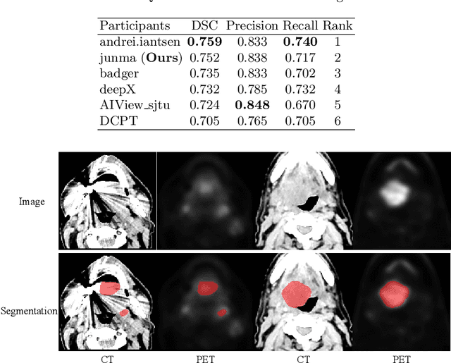Figure 2 for Combining CNN and Hybrid Active Contours for Head and Neck Tumor Segmentation in CT and PET images