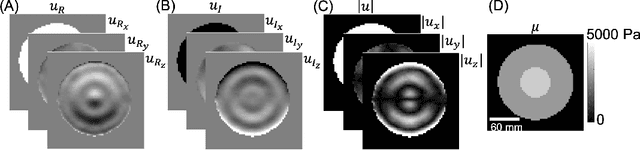 Figure 1 for Dual Objective Approach Using A Convolutional Neural Network for Magnetic Resonance Elastography