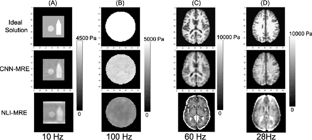 Figure 3 for Dual Objective Approach Using A Convolutional Neural Network for Magnetic Resonance Elastography