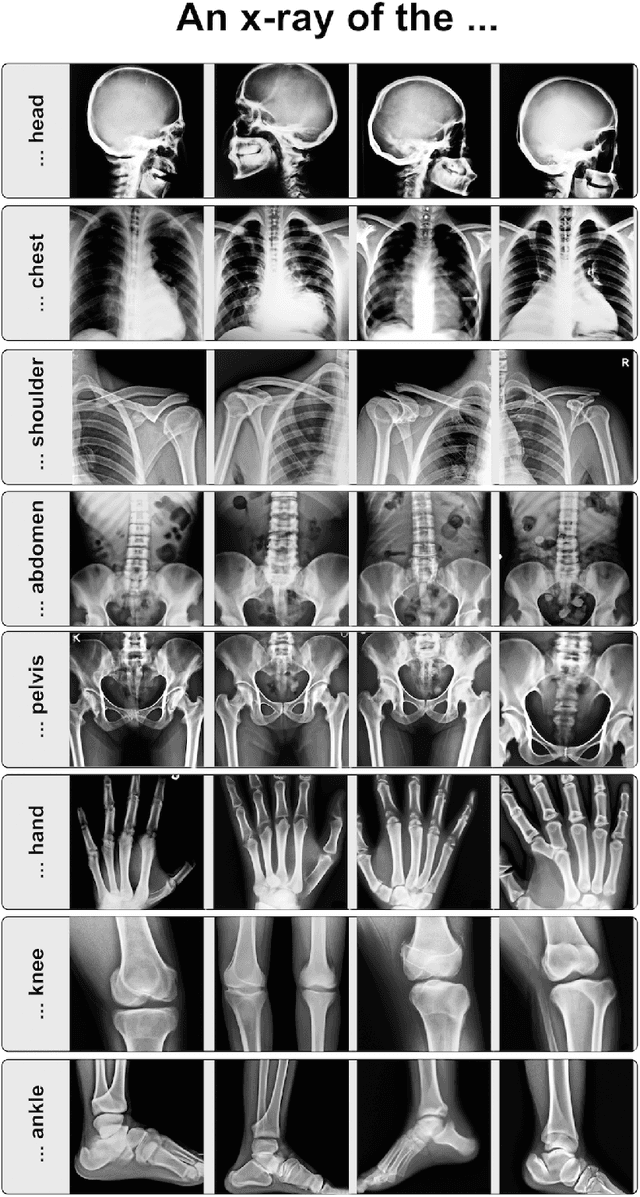 Figure 1 for What Does DALL-E 2 Know About Radiology?