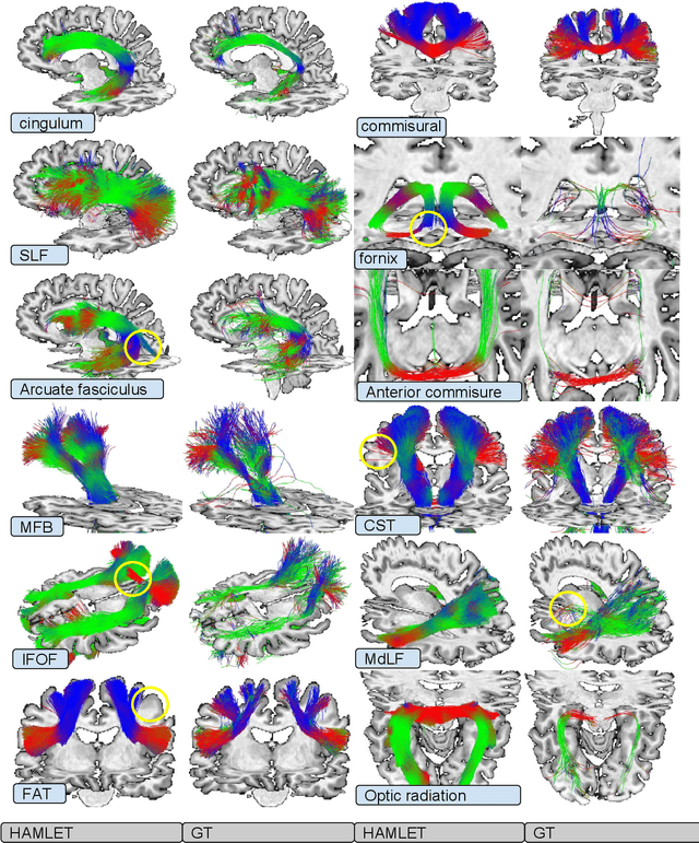 Figure 2 for HAMLET: Hierarchical Harmonic Filters for Learning Tracts from Diffusion MRI