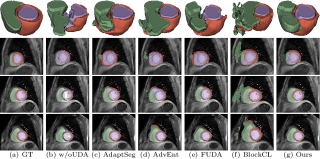 Figure 4 for ConFUDA: Contrastive Fewshot Unsupervised Domain Adaptation for Medical Image Segmentation
