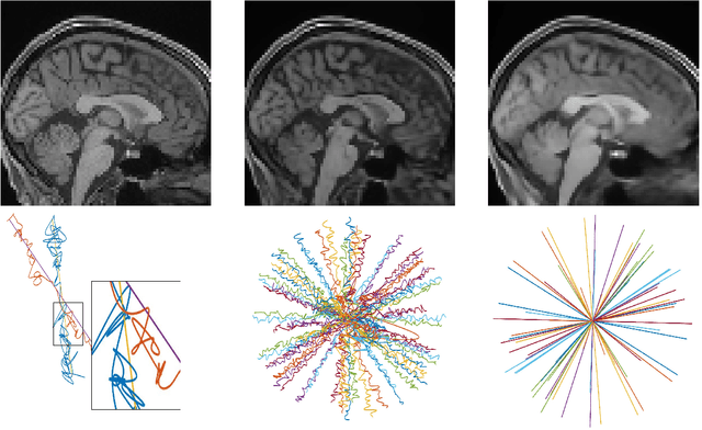 Figure 3 for 3D FLAT: Feasible Learned Acquisition Trajectories for Accelerated MRI