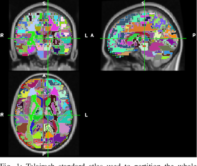 Figure 1 for On the Generalizability of Linear and Non-Linear Region of Interest-Based Multivariate Regression Models for fMRI Data