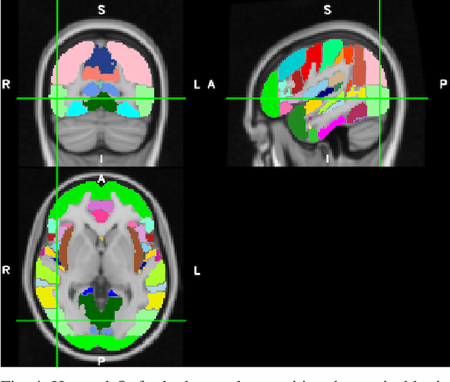 Figure 4 for On the Generalizability of Linear and Non-Linear Region of Interest-Based Multivariate Regression Models for fMRI Data