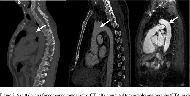 Figure 3 for AI-based Aortic Vessel Tree Segmentation for Cardiovascular Diseases Treatment: Status Quo