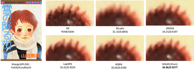 Figure 4 for Multi-grained Attention Networks for Single Image Super-Resolution