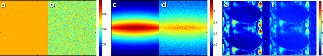 Figure 4 for Statistical Noise Analysis in SENSE Parallel MRI