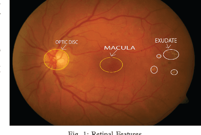 Figure 1 for An Unsupervised Method for Detection and Validation of The Optic Disc and The Fovea