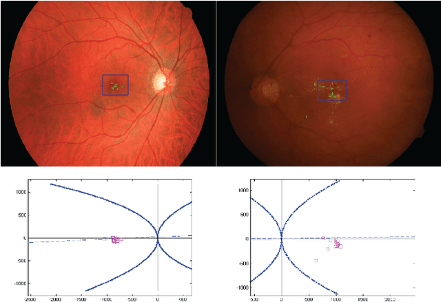 Figure 3 for An Unsupervised Method for Detection and Validation of The Optic Disc and The Fovea