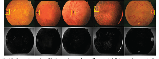 Figure 4 for An Unsupervised Method for Detection and Validation of The Optic Disc and The Fovea