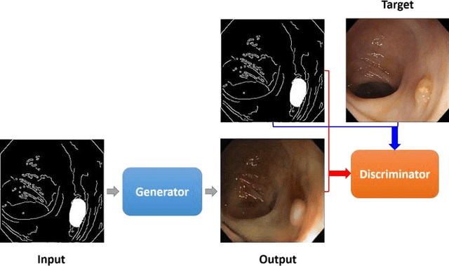 Figure 1 for Abnormal Colon Polyp Image Synthesis Using Conditional Adversarial Networks for Improved Detection Performance