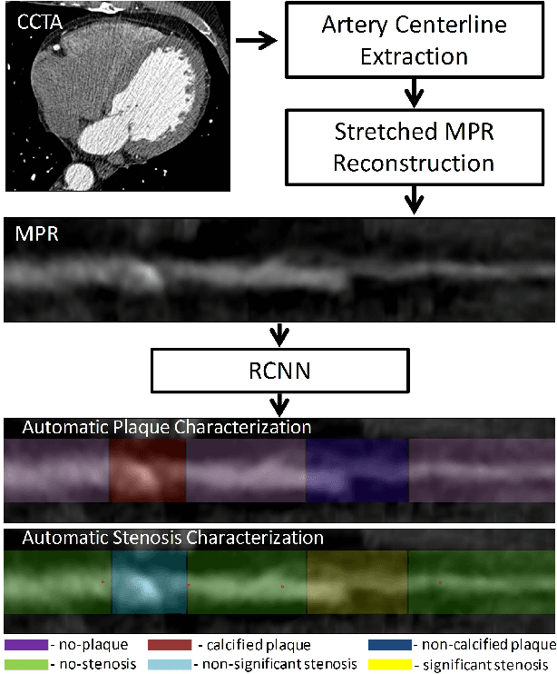Figure 2 for A Recurrent CNN for Automatic Detection and Classification of Coronary Artery Plaque and Stenosis in Coronary CT Angiography