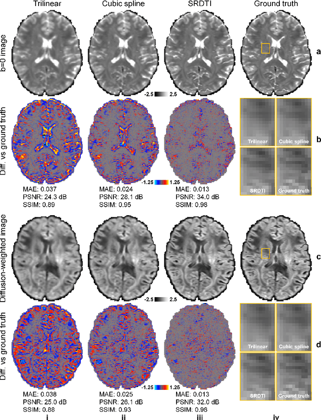 Figure 3 for SRDTI: Deep learning-based super-resolution for diffusion tensor MRI
