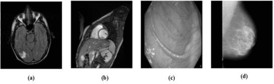 Figure 4 for Reversible Image Watermarking for Health Informatics Systems Using Distortion Compensation in Wavelet Domain