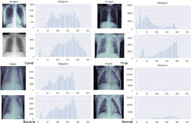 Figure 3 for Transfer learning approach to Classify the X-ray image that corresponds to corona disease Using ResNet50 pretrained by ChexNet