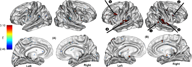 Figure 4 for Mapping individual differences in cortical architecture using multi-view representation learning