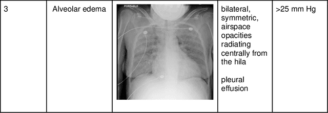 Figure 2 for Deep Learning to Quantify Pulmonary Edema in Chest Radiographs
