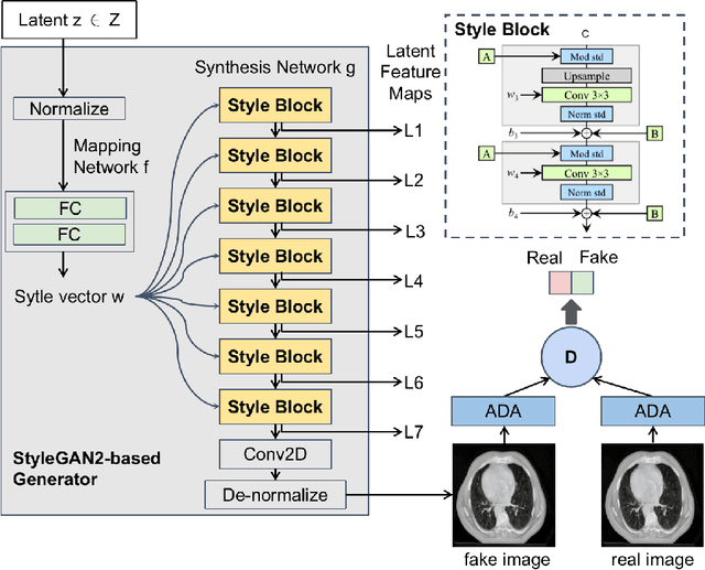Figure 3 for Application of DatasetGAN in medical imaging: preliminary studies