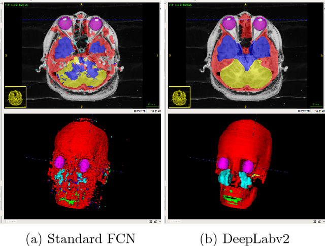 Figure 4 for Comparison of the Deep-Learning-Based Automated Segmentation Methods for the Head Sectioned Images of the Virtual Korean Human Project