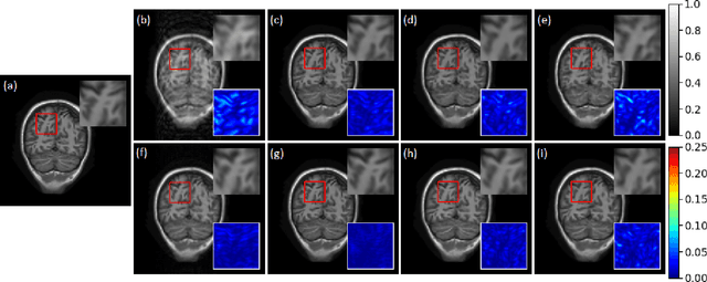 Figure 3 for Robust Compressive Sensing MRI Reconstruction using Generative Adversarial Networks