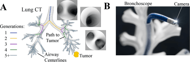 Figure 1 for Deep Learning for Localization in the Lung