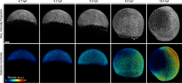 Figure 1 for Towards Automatic Embryo Staging in 3D+T Microscopy Images using Convolutional Neural Networks and PointNets