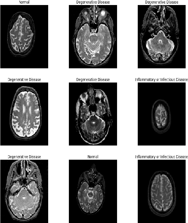 Figure 4 for Deep Transfer Learning for Brain Magnetic Resonance Image Multi-class Classification
