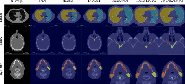 Figure 4 for Enhancing Organ at Risk Segmentation with Improved Deep Neural Networks