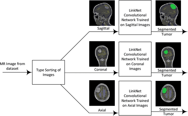 Figure 4 for Brain Tumor Segmentation Using Deep Learning by Type Specific Sorting of Images