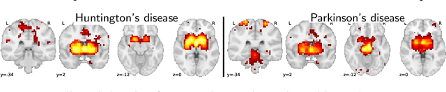 Figure 4 for Text to brain: predicting the spatial distribution of neuroimaging observations from text reports