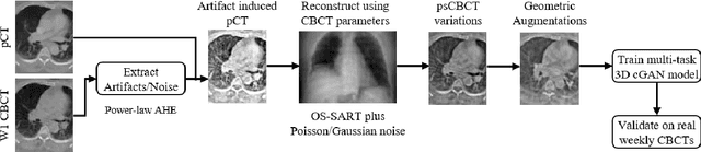 Figure 1 for Multitask 3D CBCT-to-CT Translation and Organs-at-Risk Segmentation Using Physics-Based Data Augmentation