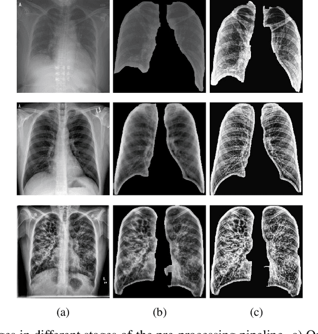 Figure 2 for MAVIDH Score: A COVID-19 Severity Scoring using Chest X-Ray Pathology Features